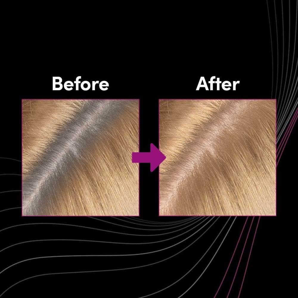 KIT RETOUCHE RACINES BLOND MOYEN SCHWARZKOPF